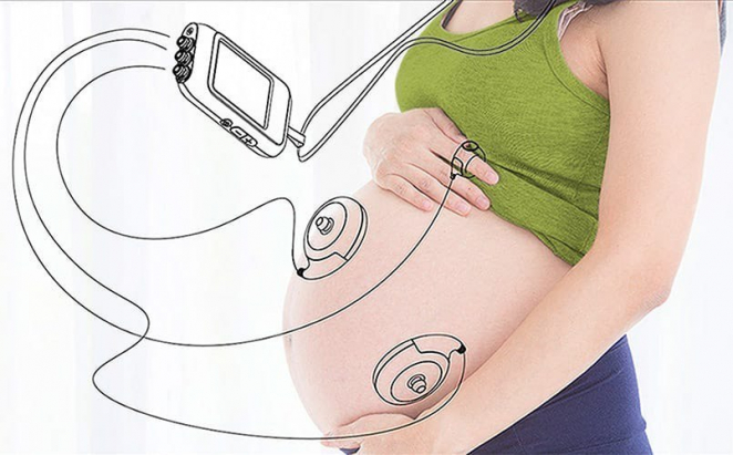 Resident of the SEZ Technopolis Moscow will launch the production of devices for remote pregnancy management